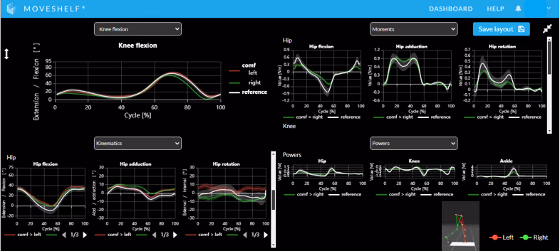 Innovative workflow including Machine-learning Assisted Movement Analysis system and cloud-based infrastructure for children with cerebral palsy