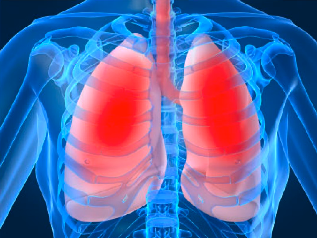 Understanding the effects of plant stanol esters in the prevention of clinical symptoms related to asthma