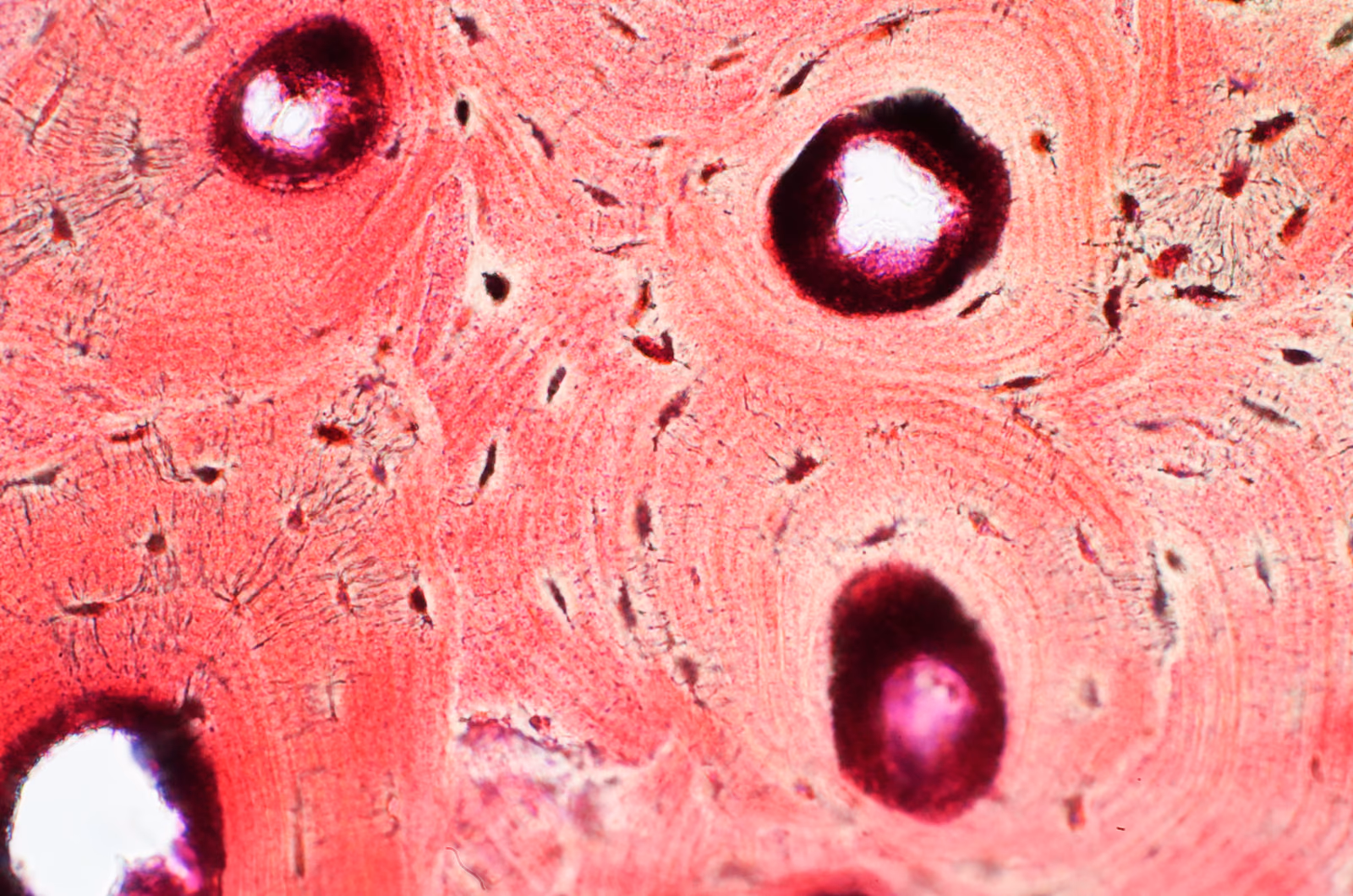 Nutritional nanoparticles for improved bone formation and healing