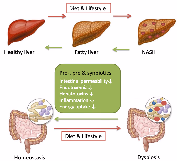 The BARNARD-study: Butyrate-producing intestinal bActeria to pReveNt progression from non-alcoholic fAtty liveR Disease to non-alcoholic steatohepatitis