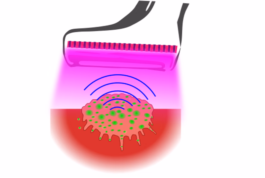 Precision Tumor Resection with Deformable and Targeted Photoacoustic Imaging