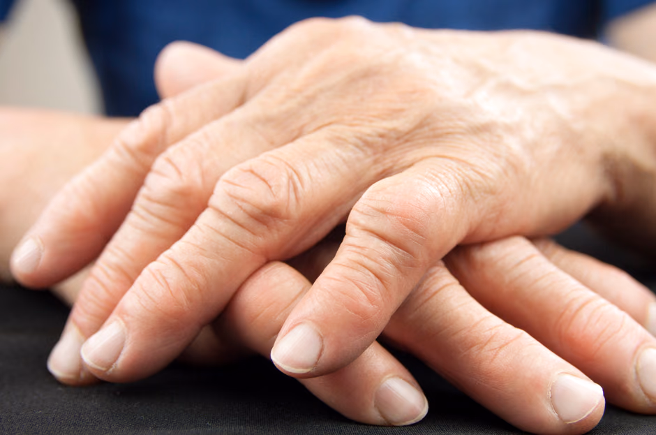 A high throughput human osteoarthritis screening platform - target identification acting on the debilitating effect of dysfunctional hypertrophic osteoarthritic chondrocytes. Fight hypertrophic OsteoArthritis Cartilage - towards an Ultimate Solution