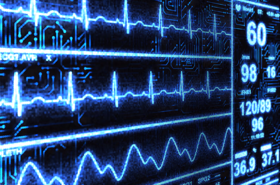 CARE-ON: Cardiovascular Research Opting for New Applications: continuous cardiac risk and lifestyle profiling