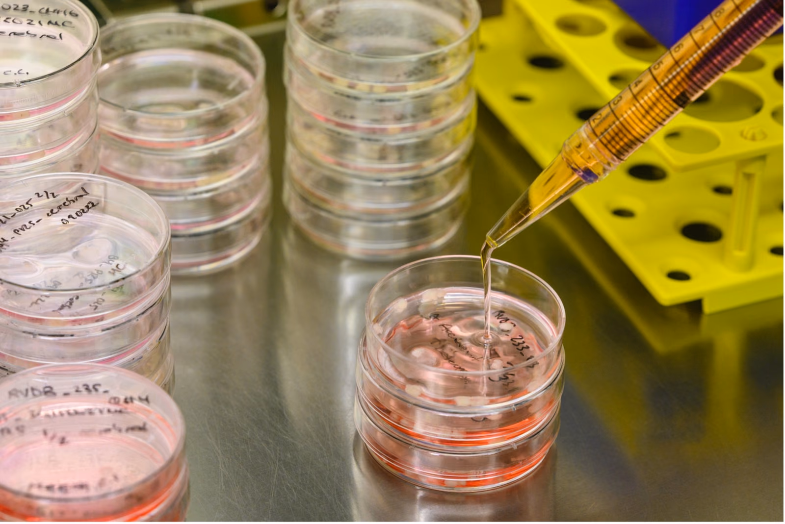 Exploring Reactive Gliosis in Dementia with Human iPSC-Derived Models: Gaining Mechanistic Insight and Assessing Functional Impact