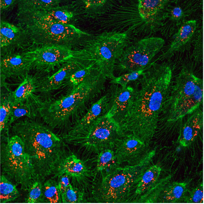Treatment of immune and degenerative disease with stem cell-derived particles