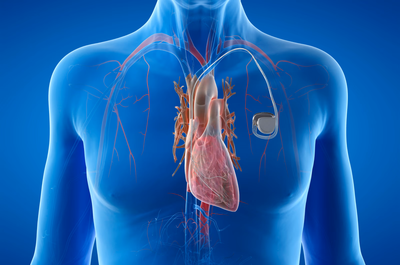 Cardiac GPS: Gaussian-Process Safety navigation system for cardiac pacemaker lead placement