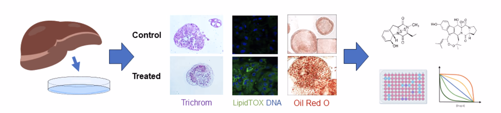 Adult Human LIver-derived orgaNoid platForm for modeLing metabolic and FATty livEr Diseases and identifying new therapeutic strategies (INFLATED).