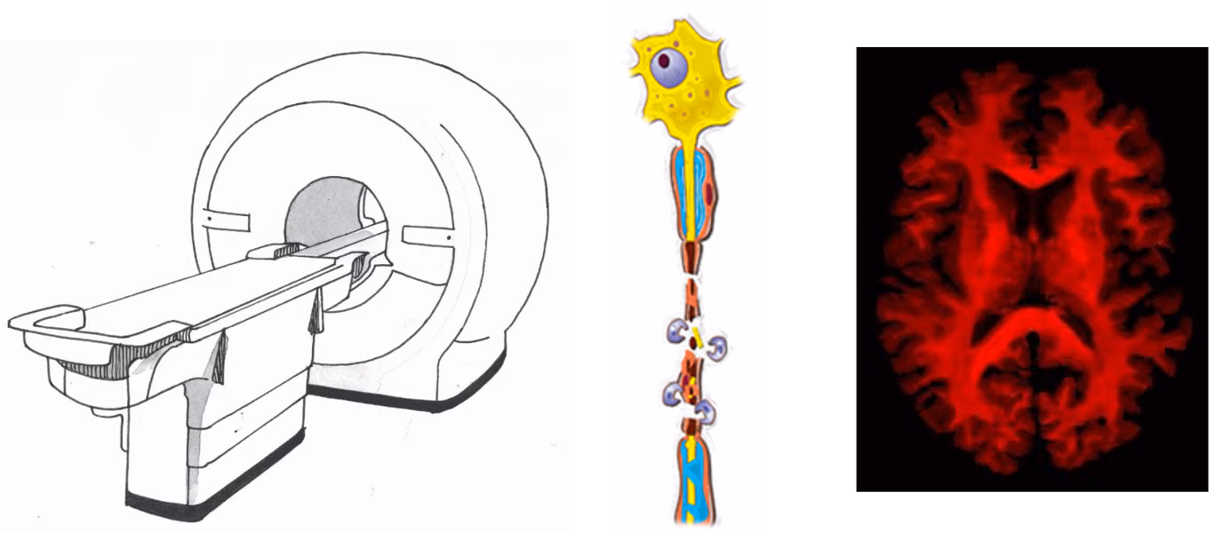 Making myelin imaging better in brain diseases