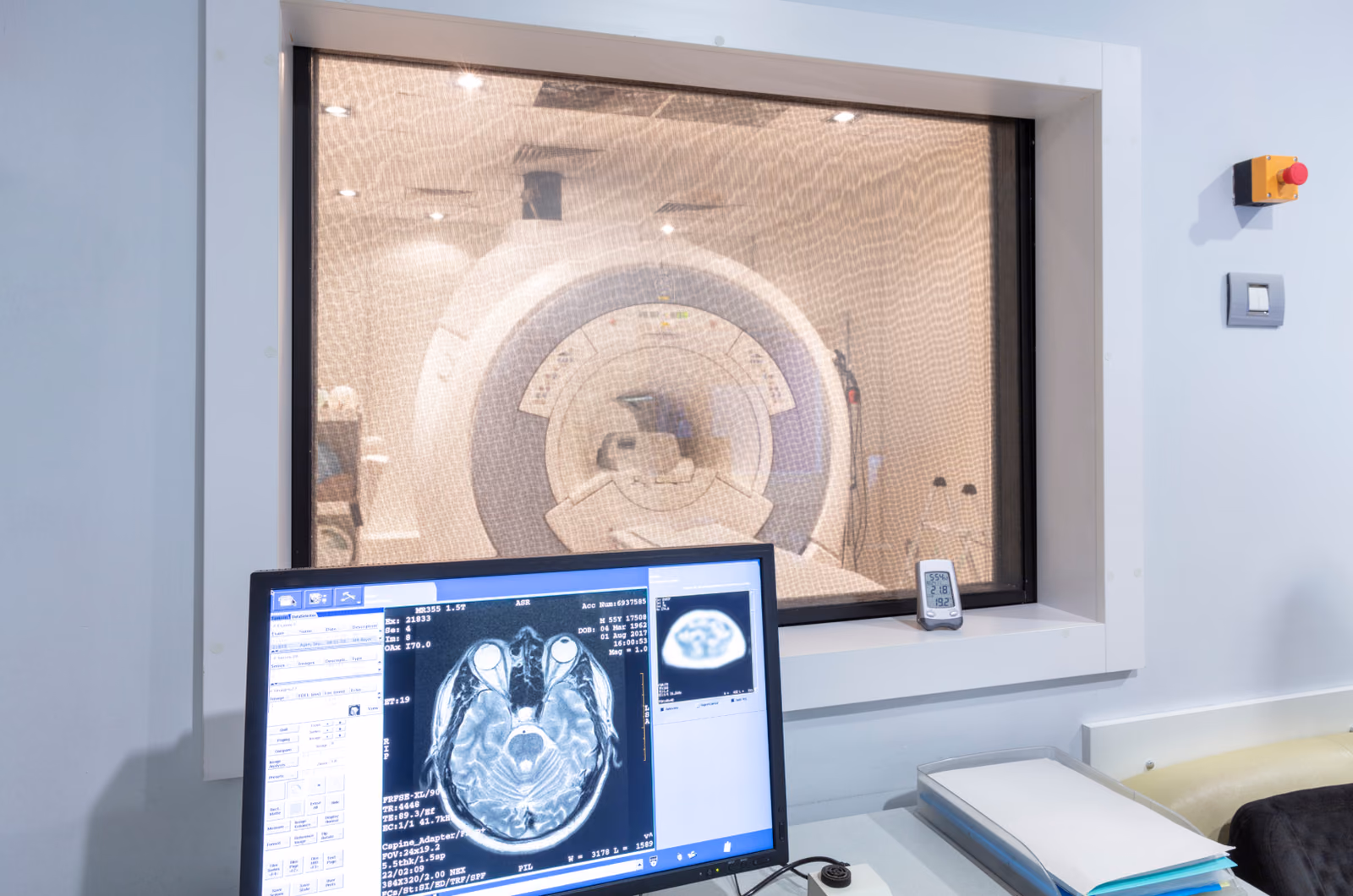 Brain@risk: Early detection and quantification of cerebrovascular disease