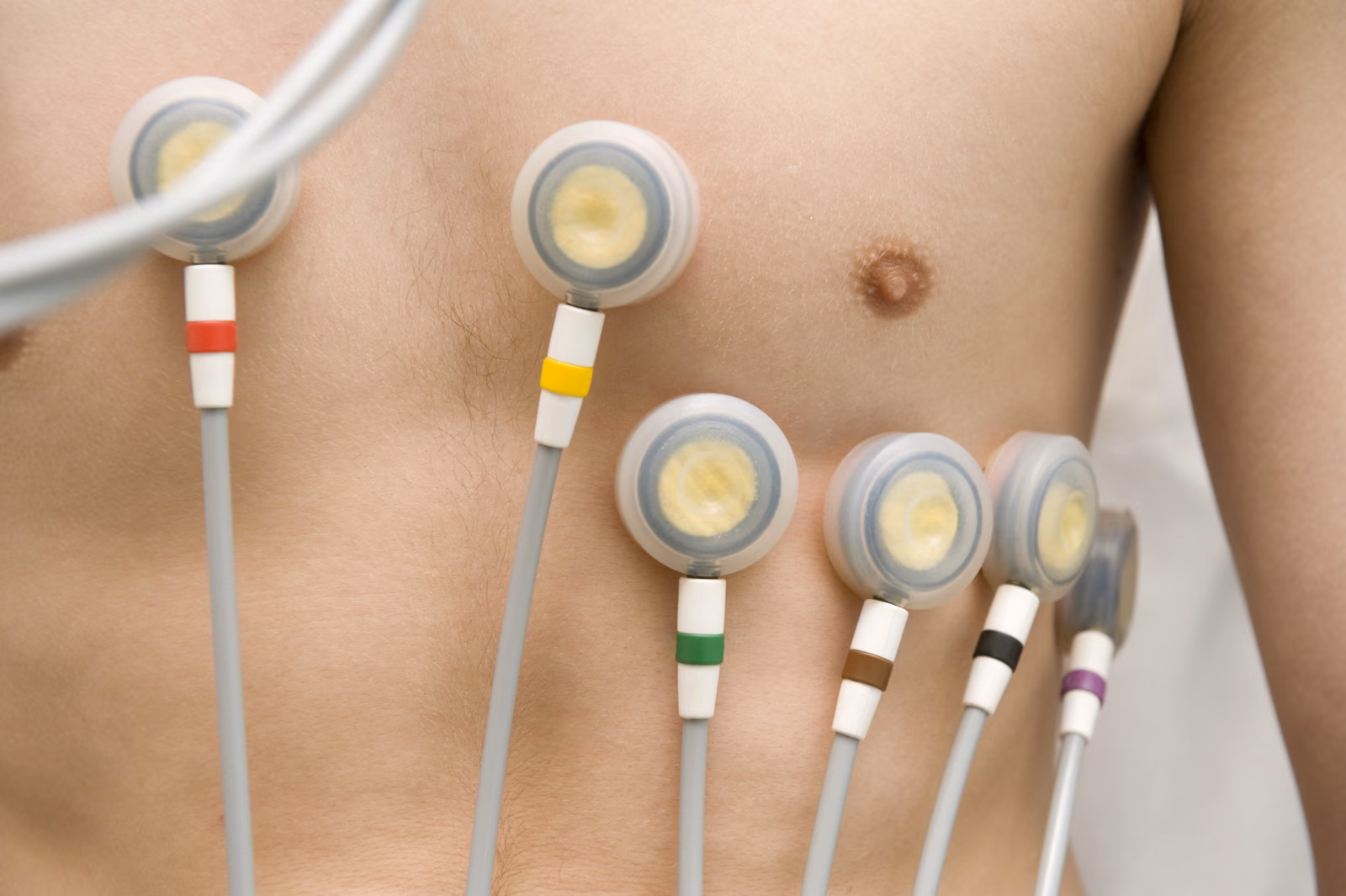 Validation First Line CineECG