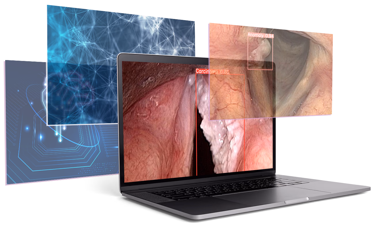 AI-based image analysis for enhancing Head and Neck Cancer detection during upper airway endoscopy (ENHANCE)