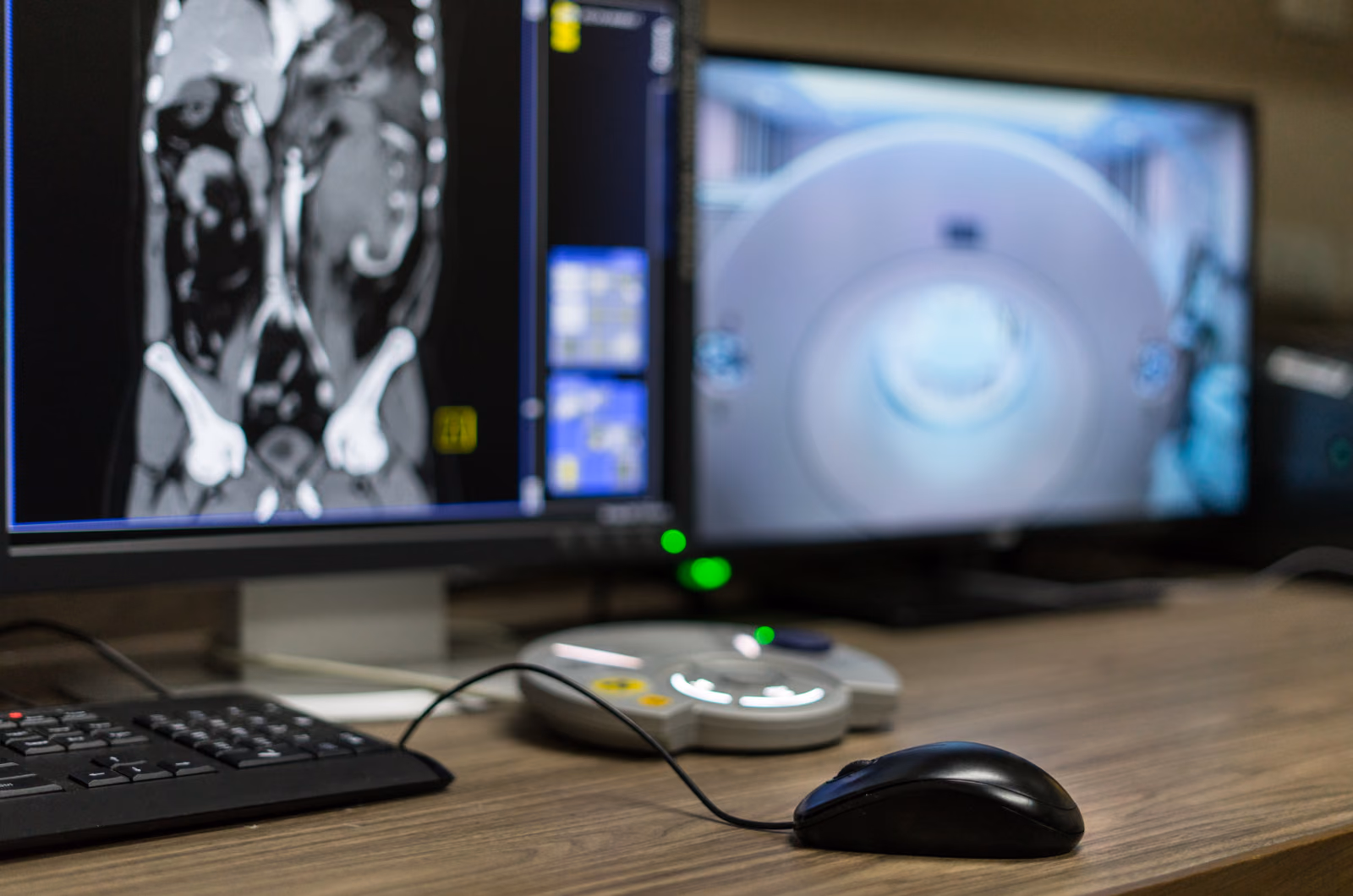 Comprehensive artificial intelligence in chest CTs including incidental pulmonary embolism