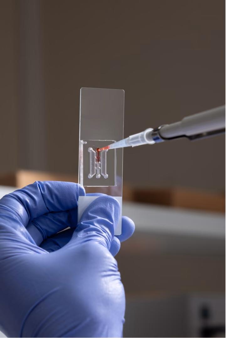 Development of a lymphoma-on-chip model for testing therapeutic strategies LYMPHOMACHIPTHERA