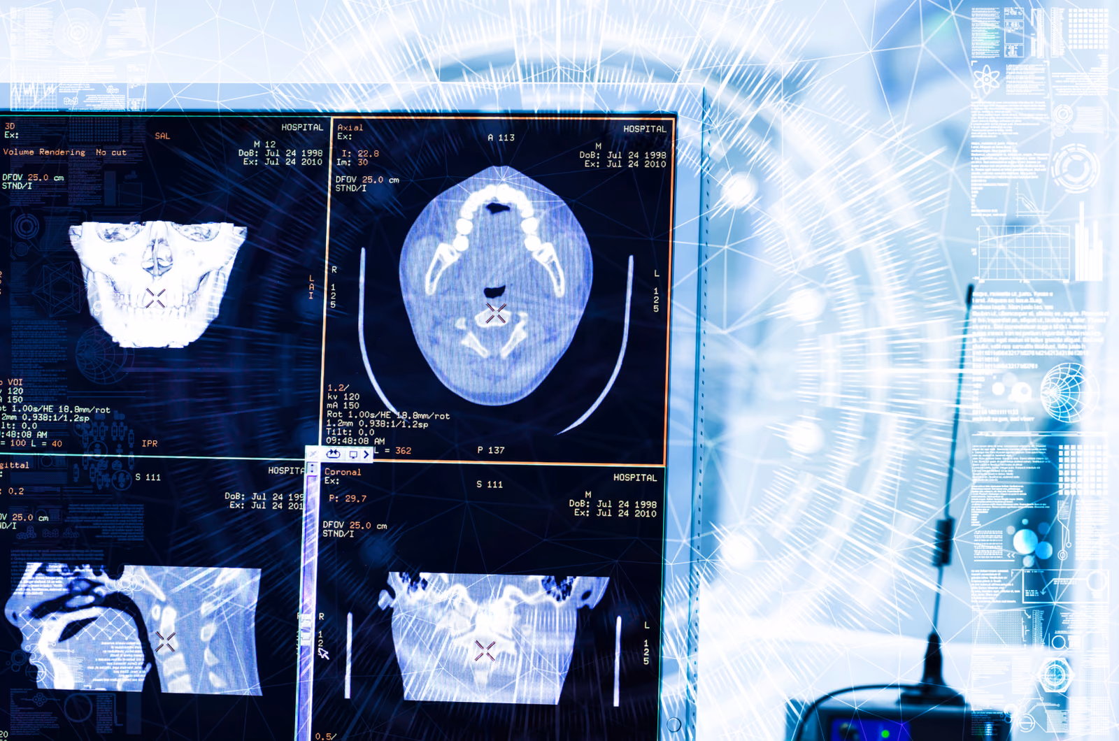 Using artificial intelligence to train computers to analyse PET/CT scans of bone and joint abnormalities in spondyloarthritis.
