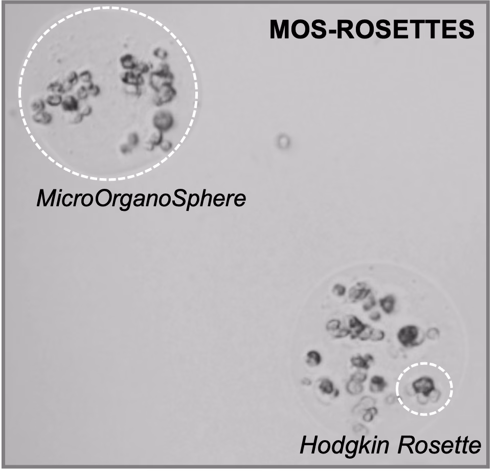 MOS-ROSETTES: Inhibiting the formation of T-cell rosettes in Hodgkin lymphoma using MicroOrganoSpheres to develop more targeted less toxic treatment