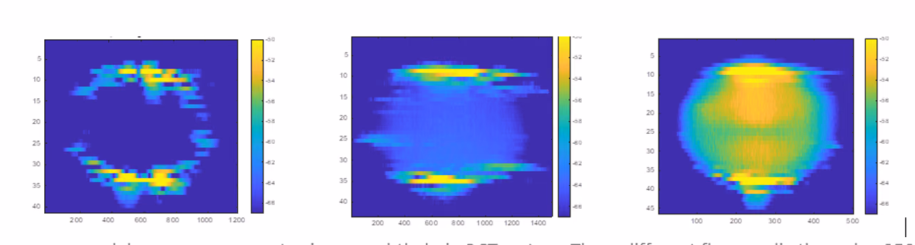 Quantitative analysis of blood velocity in the retina.