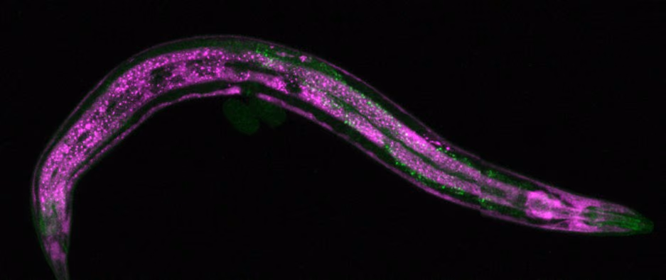 Finding interventions to boost resilience to age-related neurodegeneration
