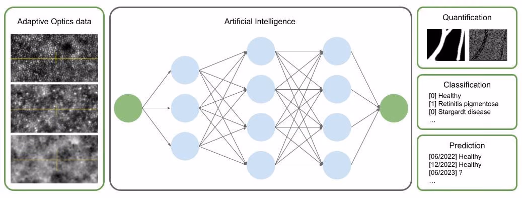 AO-Vision: prediction of inherited retinal diseases using AI in high-resolution images