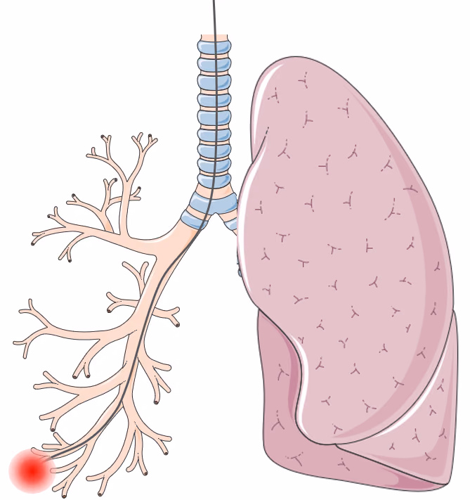 Next-generation micromotor catheters for imaging tissue stiffness with light