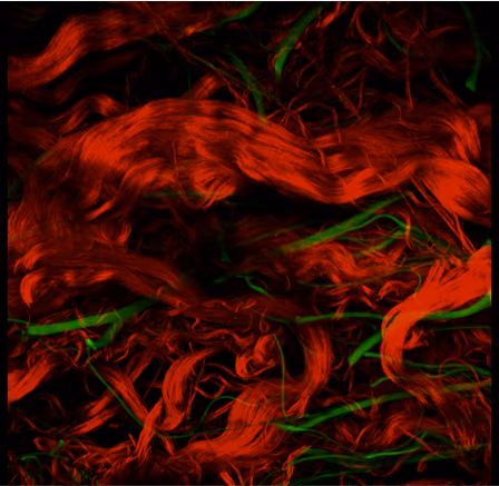Dynamic 3D microstructural and mechanical studies of in vivo and ex vivo skin to improve the skin stretch technique for burn wound reconstruction.
