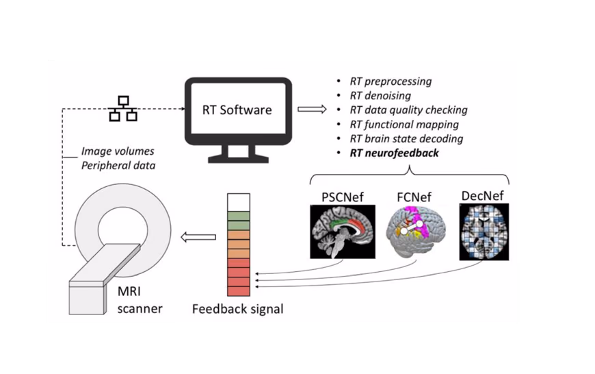 Real-time fMRI neurofeedback to better identify and treat cognitive impairments in epilepsy.
