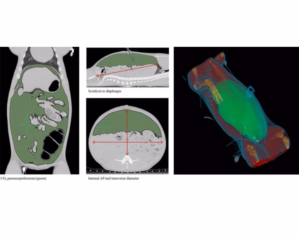 CT measurements of the effects on surgical workspace of regular versus deep neuromuscular blockade: studies in a porcine laparoscopy model