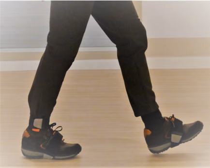 MOTOR: A tool to monitor mobility changes in knee osteoarthritis