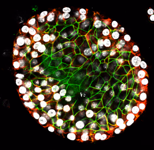 The COPD exacerbation as a therapeutic window for lung repair