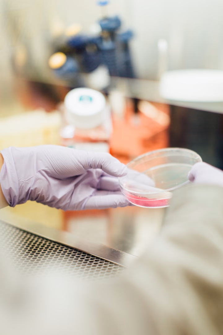 Understanding intErplay Material bacterIaL orthopaedic InfectiOns (EMILIO)