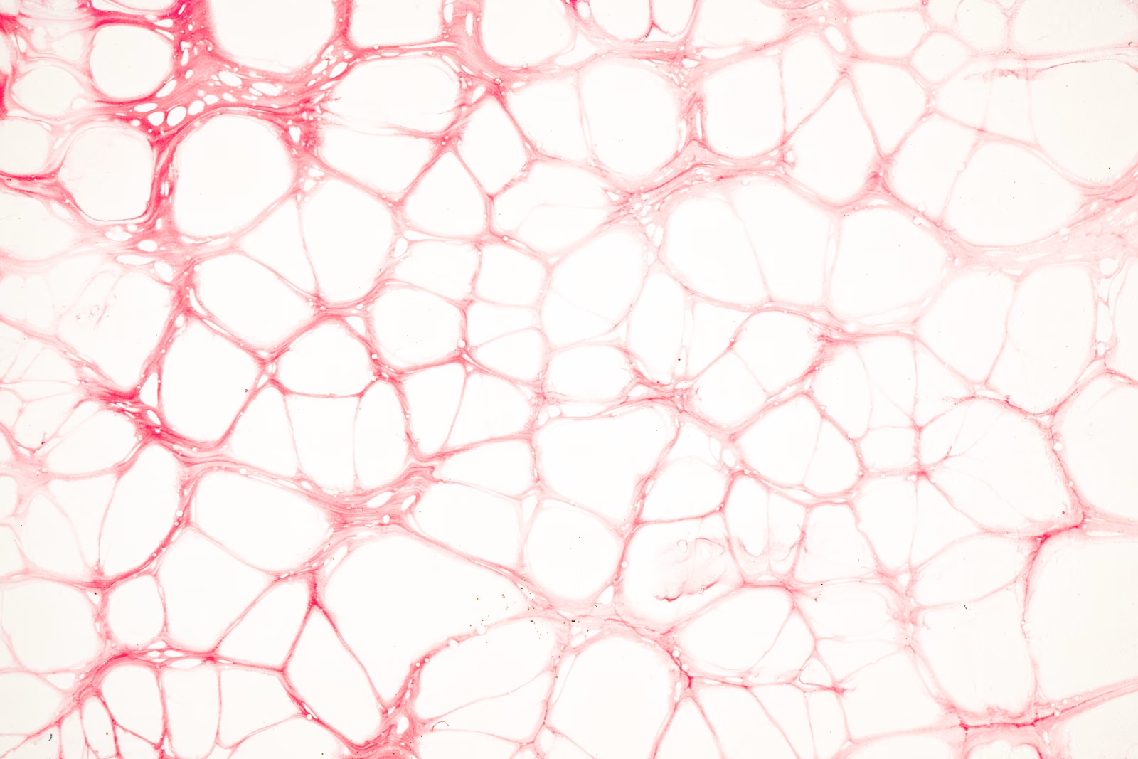 Exploring the role of vascularisation on the maturation of human pluripotent stem cell-derived pancreatic progenitors toward functional beta-cells