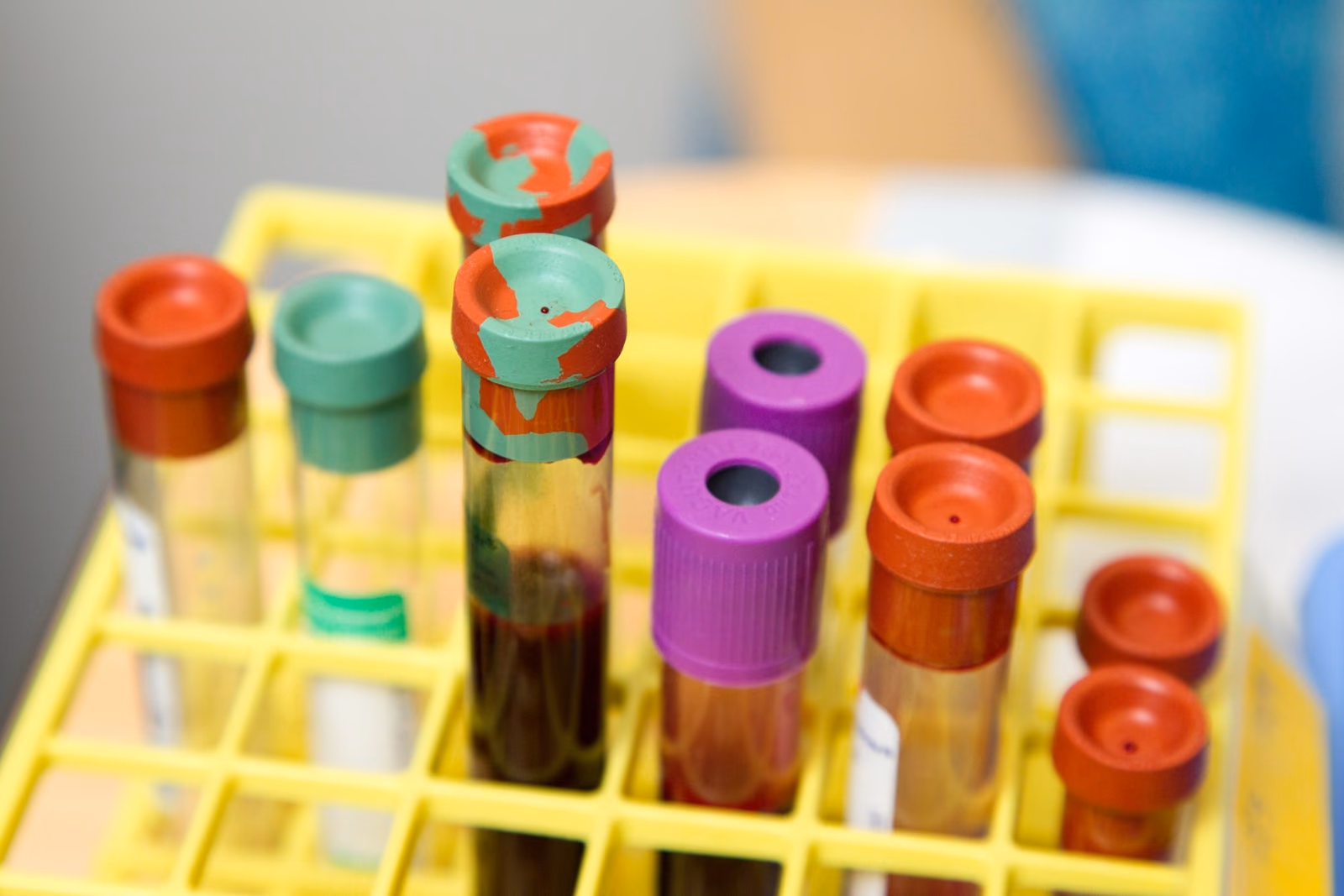 Validation of newly identified targets in AML