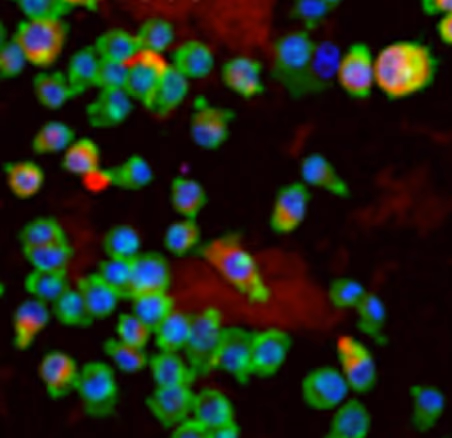 Stromal tissue-macrophage interactions in pulmonary fibrosis