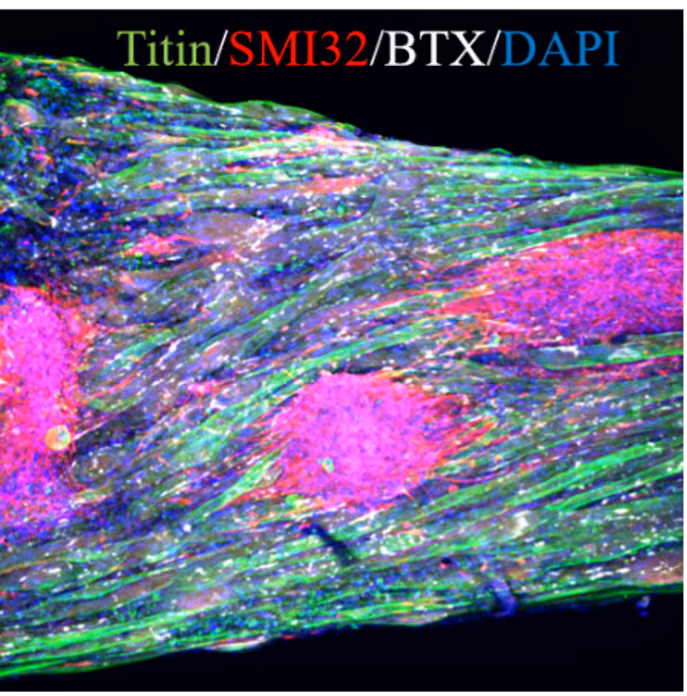 iPSC-based NMJ-on-a-chip for neuromuscular disease modelling (NOACH, NMJ-On-A-CHip)