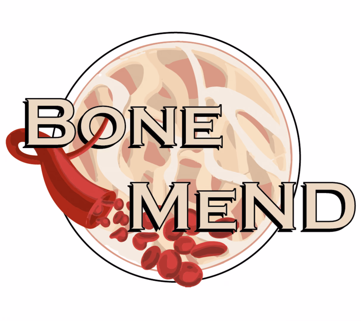 Bone metastasis “in a dish”: engineering vascularised bone in vitro to model metastatic breast cancer; BoneMeND