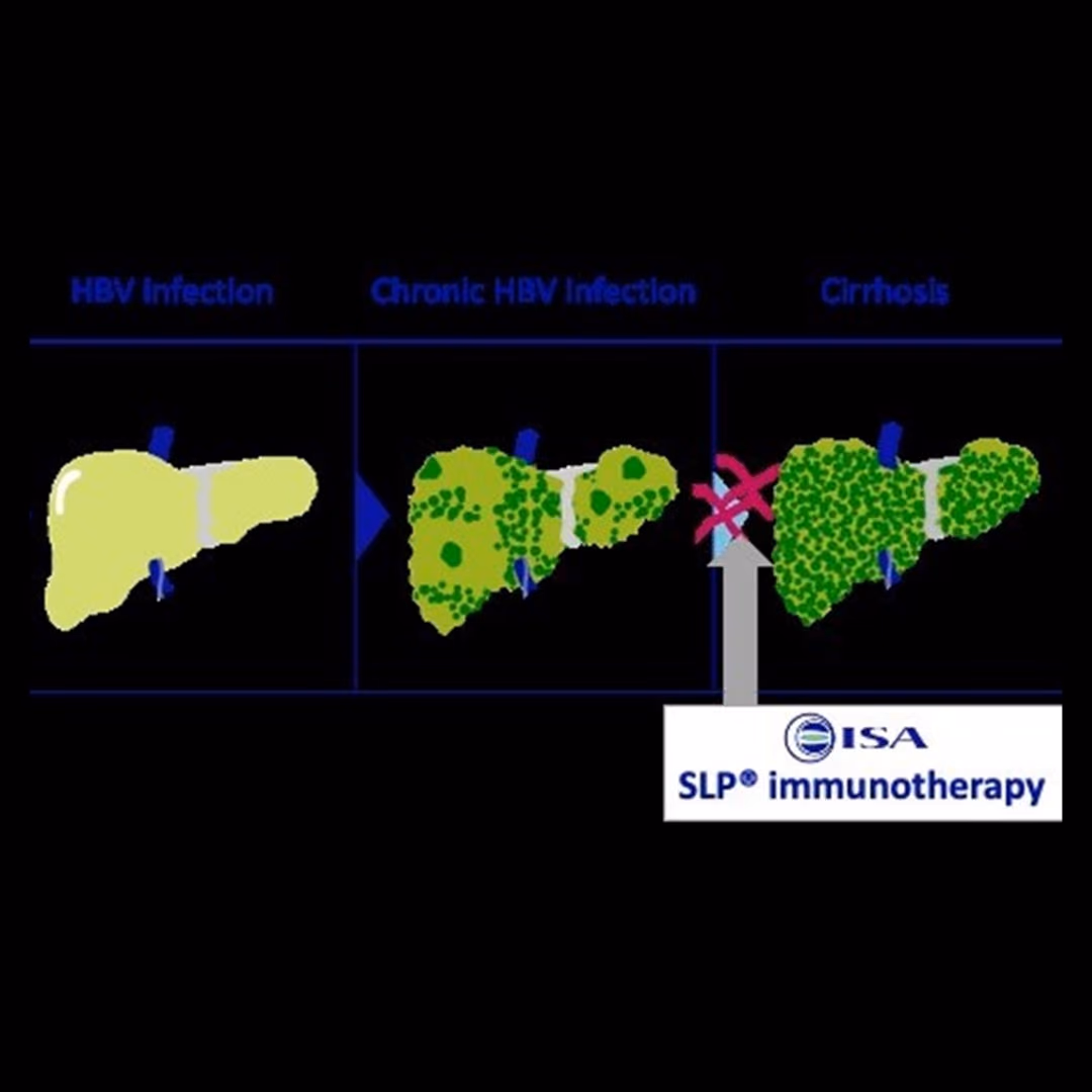 Design of effective synthetic long peptide (SLP)-based therapeutic capable of inducing an effective immune response against hepatitis B virus-infected cells by avoiding immune tolerance and viral resistance
