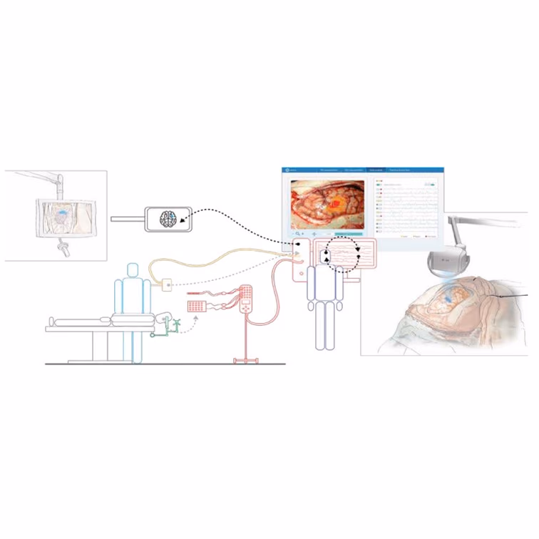 Episign: high frequency oscillations based epilepsy surgery