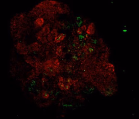 An hiPSC-based fluorescent reporter imaging platform for drug discovery to combat polycystic kidney disease, KIDNEY3D