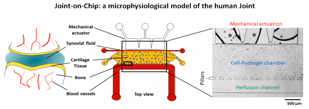 Towards osteoarthritis fingerprinting – combining imaging biomarkers and multi-organ-on-chip technology for improved in vitro models