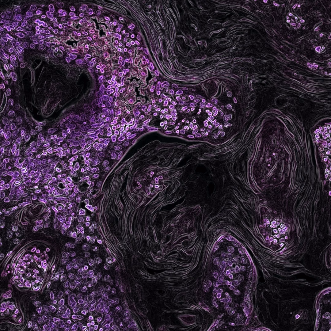 To select the right cancer patient for the best (optimal) immunotherapeutic approach