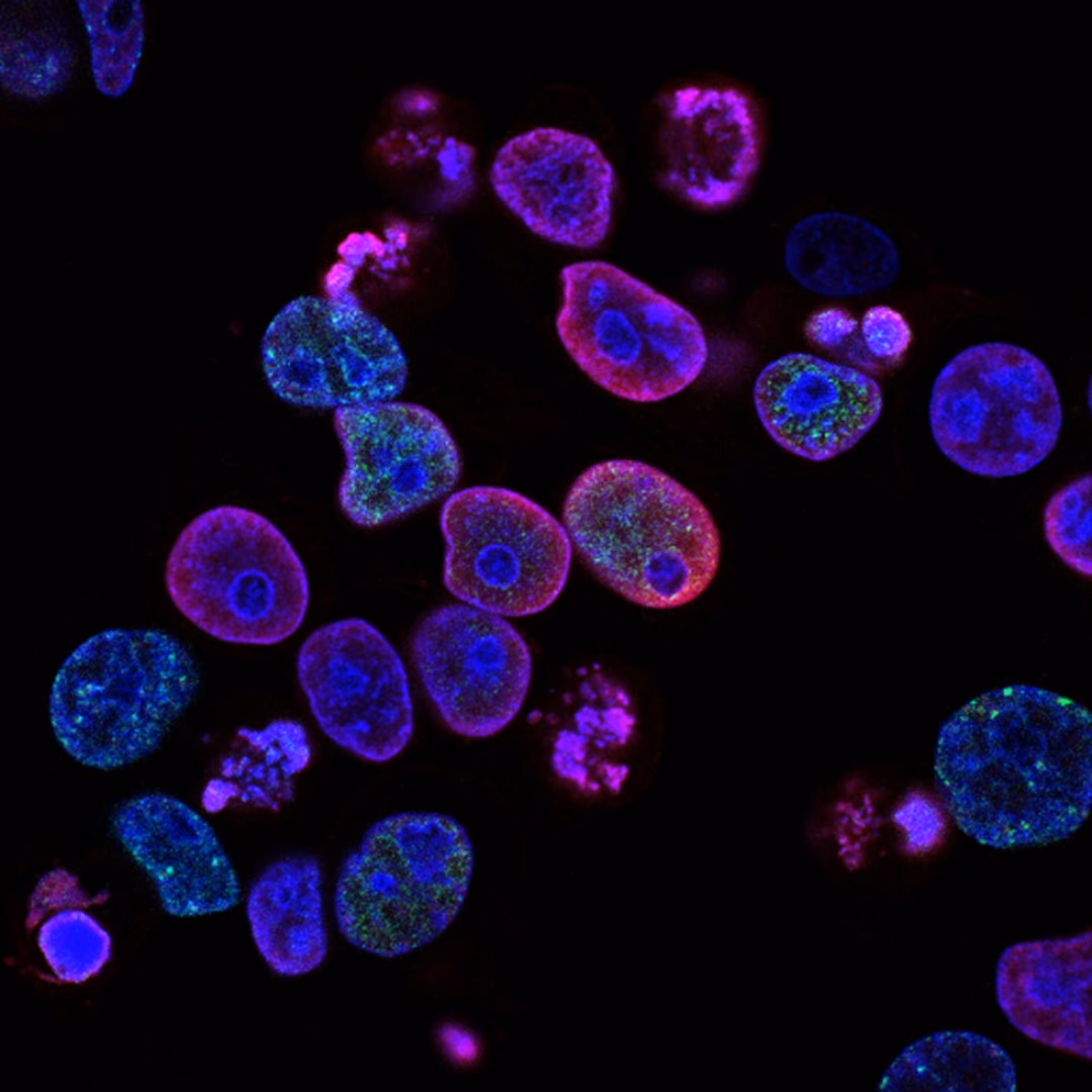 Identification of specific drug sensitivities to eradicate leukemic stem cells