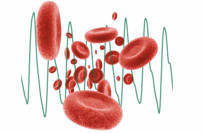 Non-invasive sepsis detection: development of a novel microcirculation monitoring technology to reduce newborn mortality