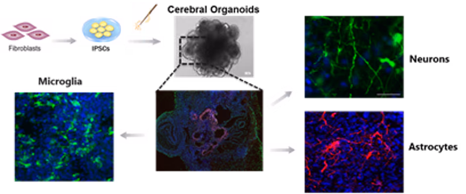 Organoids2CureHIV: Evaluation of the use of a human brain organoid model as an alternative to post-mortem human brain tissue to accelerate HIV cure