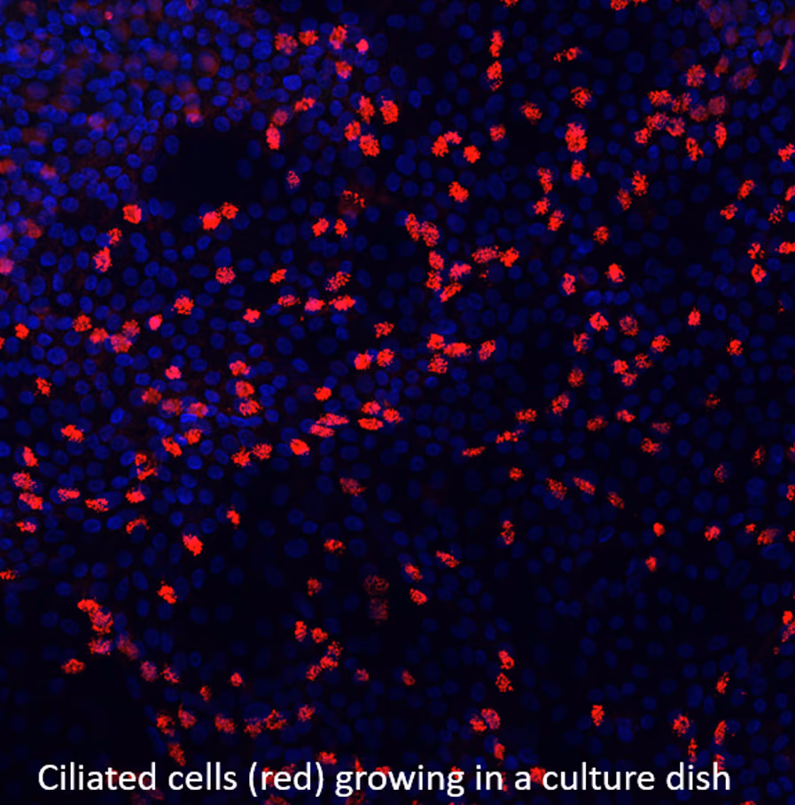 Novel targets and drugs for the treatment of viral infections of the human pulmonary system