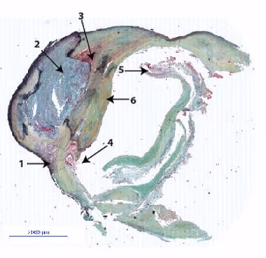 GENIUS and IN-CONTROL in transition; a novel ex-vivo based model system to study atherosclerosis