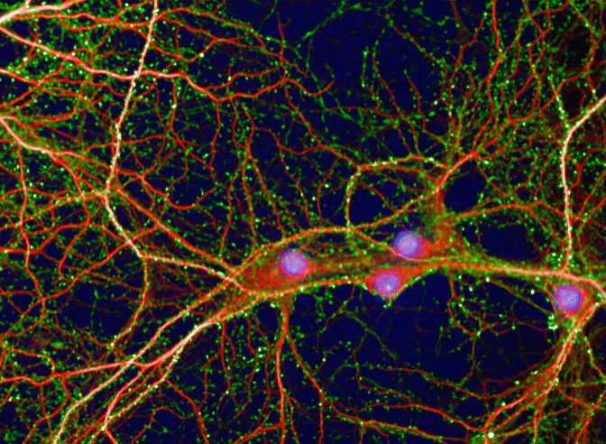 High-content assays for human neurons: a proof-of-concept study into neuronal network impairments in frontotemporal dementia.