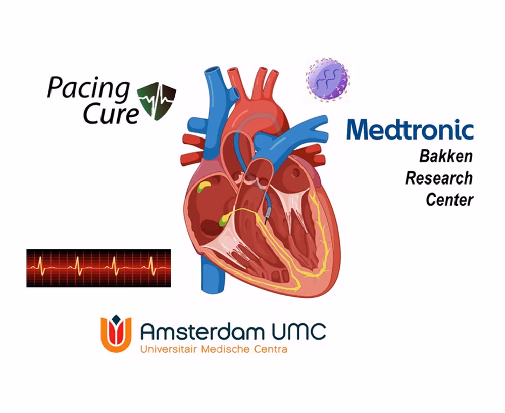 Lentiviral biological pacemakers that express HCN2/SkM1