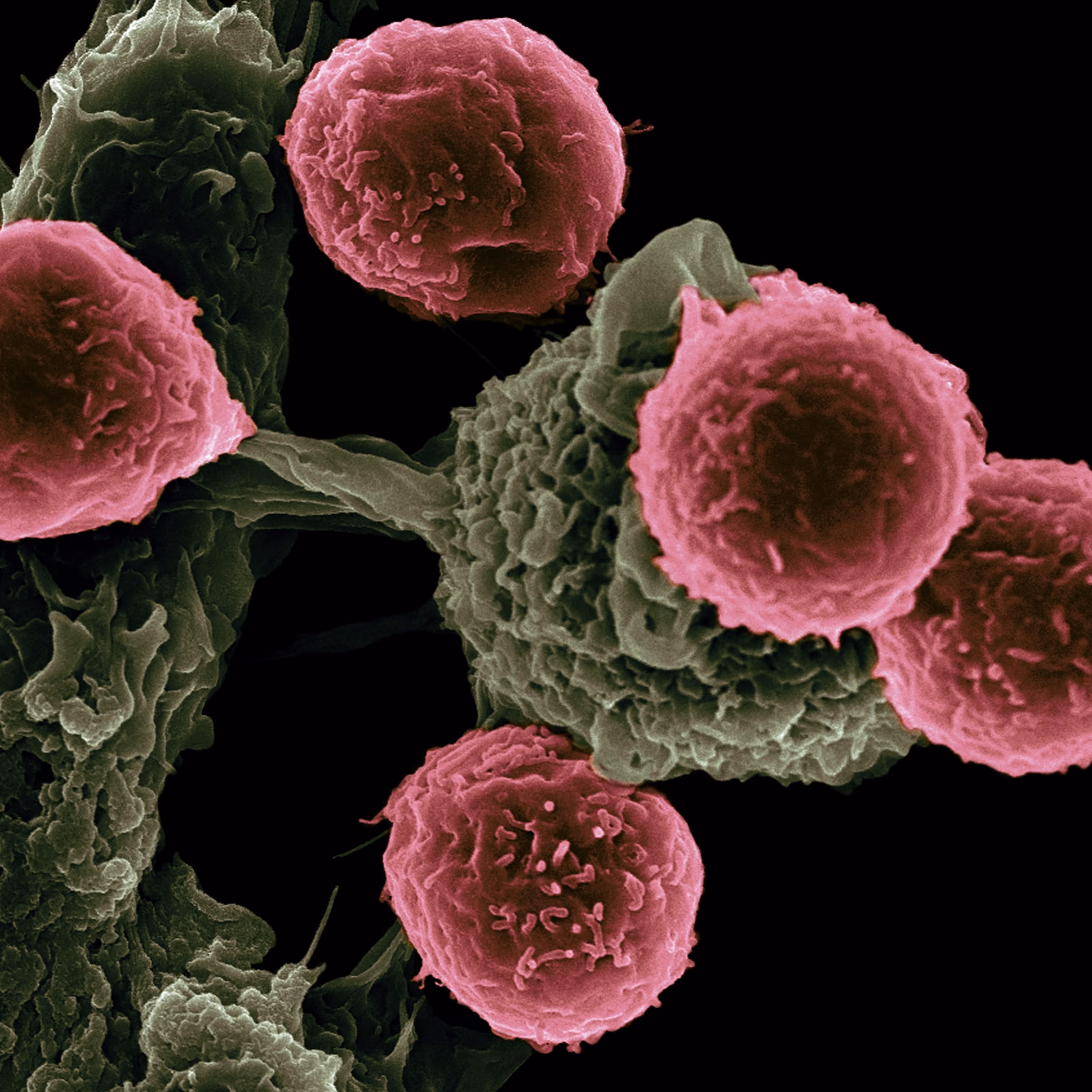 Personalised Radiotherapy