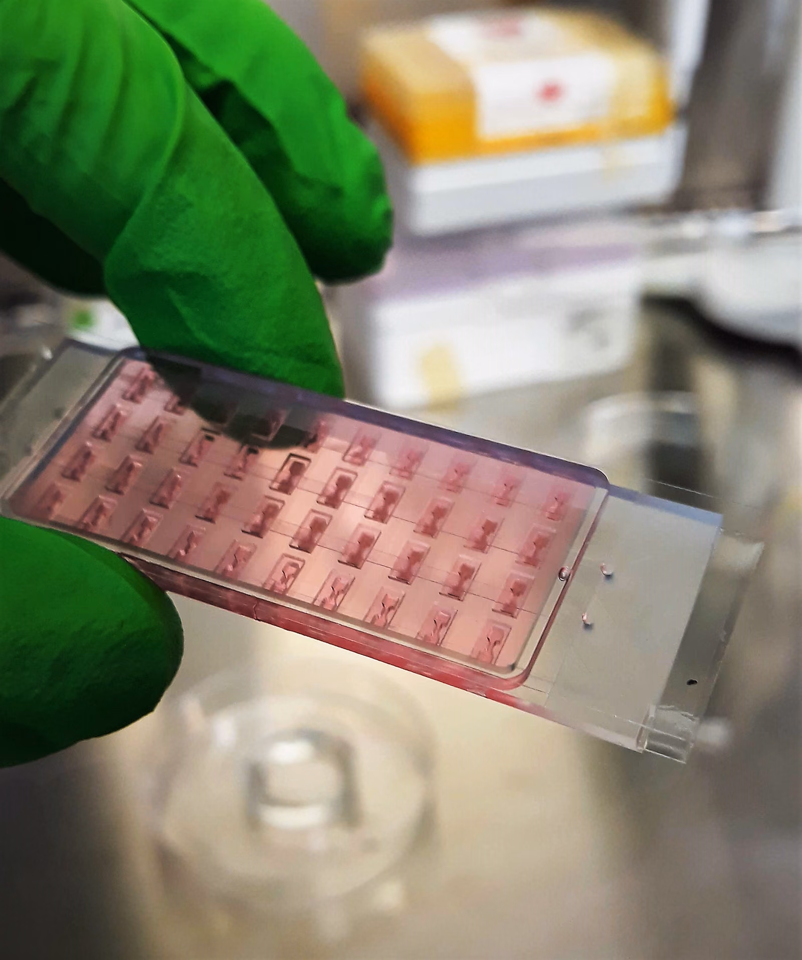 MONACO-sprint: Modeling and attacking COVID-19 with Organs-on-Chips