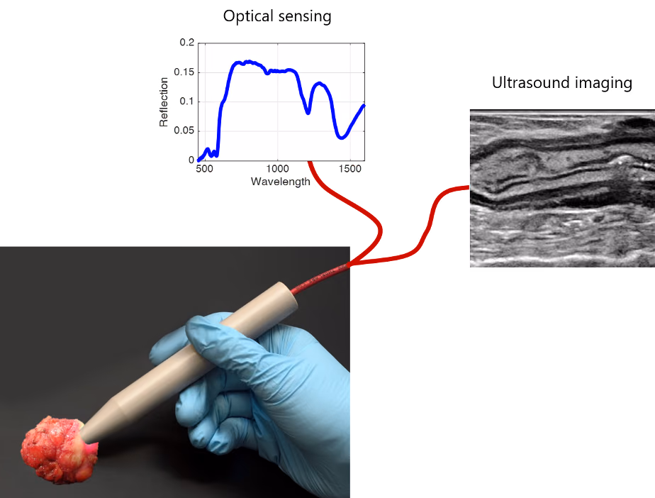 Combining Optics and Acoustics for Realtime Guidance during Cancer Surgery