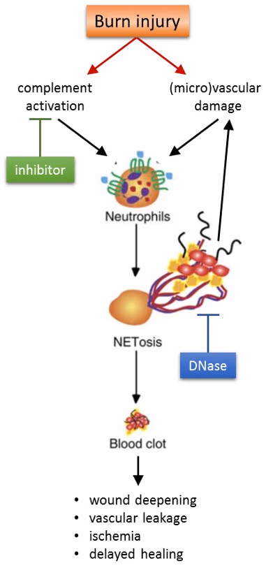 White blood cells as triggers of long term blood clot formation after burn injury and resultant burn wound deepening